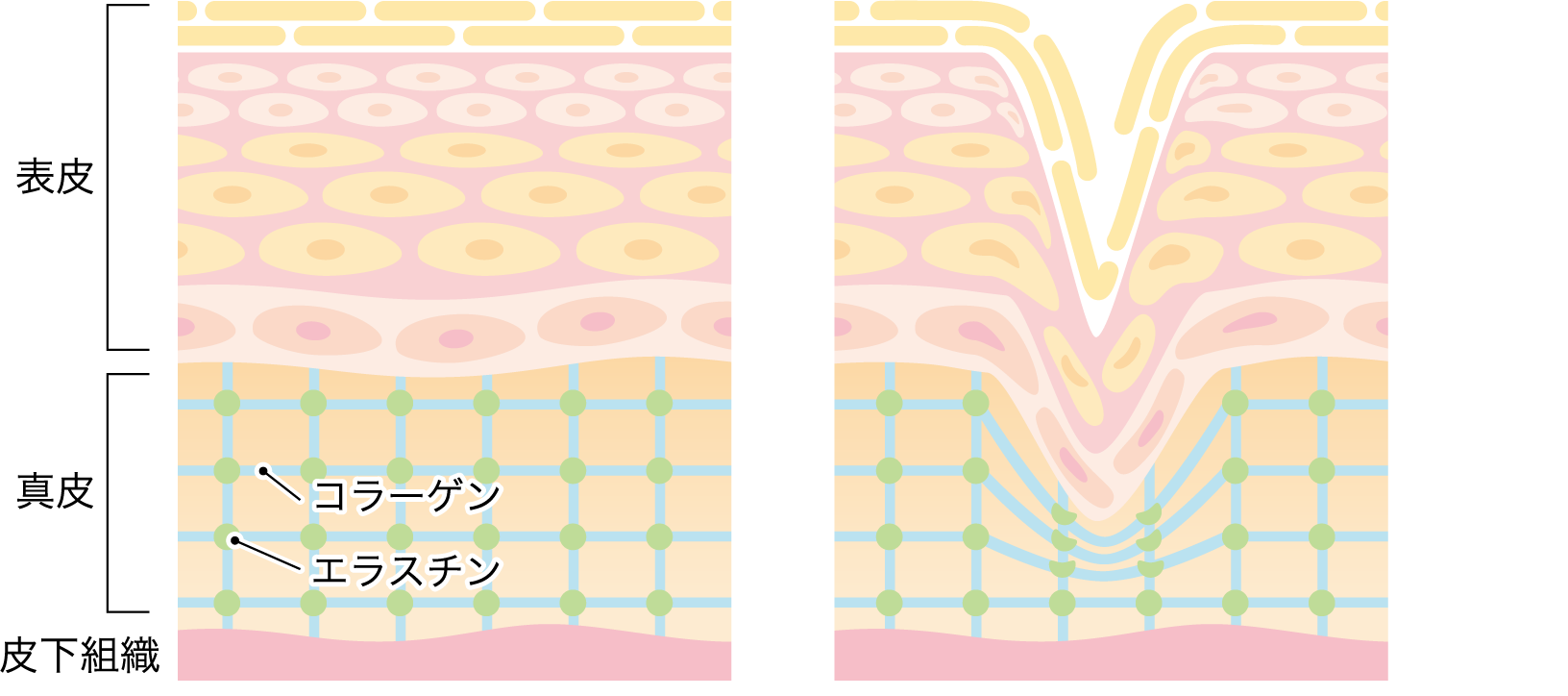 加齢による組織の変化