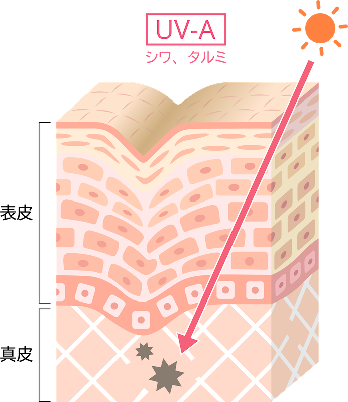 紫外線による光老化