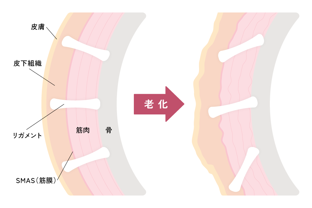加齢による組織の変化